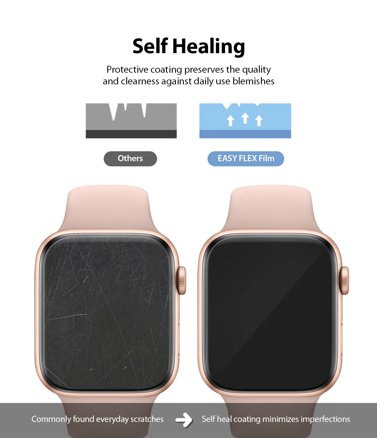 Apple Watch Series (41mm / 40mm) | Easy Flex - Image 7